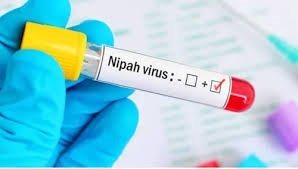 No Need to Panic Over Nipah Virus Cases in India: South Africa