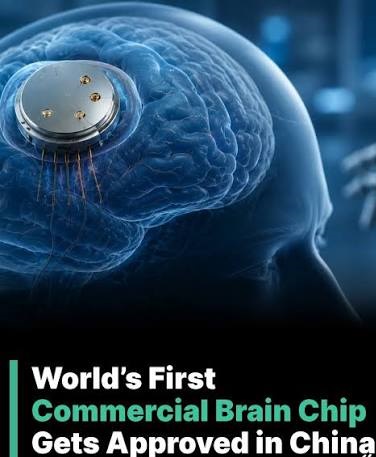 China Overtakes Neuralink in Brain Chip Race; World’s First Commercial BCI Implant ‘NEO’ Approved 1 China Overtakes Neuralink in Brain Chip Race; World’s First Commercial BCI Implant ‘NEO’ Approved