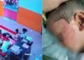 Lucknow Nursery Student Allegedly Slapped 52 Times by Class Monitor; School Expels Student Monitor, Police Begin Probe