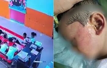 Lucknow Nursery Student Allegedly Slapped 52 Times by Class Monitor; School Expels Student Monitor, Police Begin Probe 2 Lucknow Nursery Student Allegedly Slapped 52 Times by Class Monitor; School Expels Student Monitor, Police Begin Probe