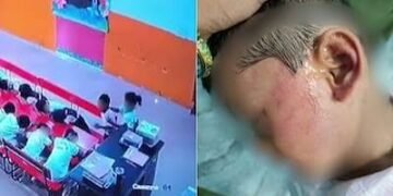 Lucknow Nursery Student Allegedly Slapped 52 Times by Class Monitor; School Expels Student Monitor, Police Begin Probe