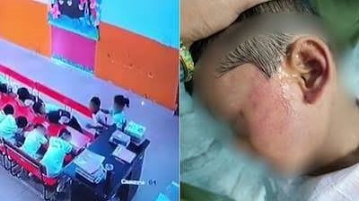 Lucknow Nursery Student Allegedly Slapped 52 Times by Class Monitor; School Expels Student Monitor, Police Begin Probe 1 Lucknow Nursery Student Allegedly Slapped 52 Times by Class Monitor; School Expels Student Monitor, Police Begin Probe